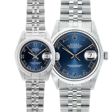 his & hers rolex watches|what is his in medical.